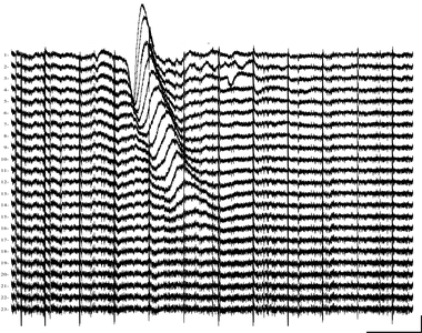 Electrophysiology of CoSD