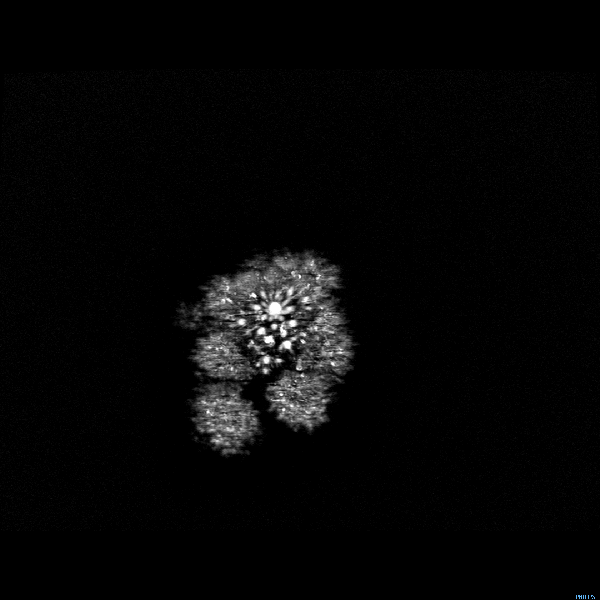 Ellison created this animation from MRI scans of broccoli. Image courtesy of Andrew Ellison