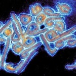 Colorized electronic micrograph of Marburg virus
