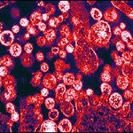 Lassa virus particles