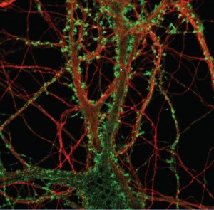  Hippocampal neuron showing dendritic spines (green), and axons/dendrites (red).  Image Credit: Cheng Fang. 