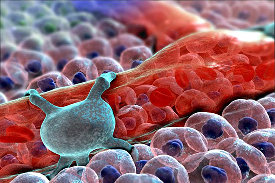 A spider-shaped pericyte, seen here in light blue, encircles a capillary, helping maintain the blood-brain barrier. The gene FOXF2 seems to affect pericytes, leading to small vessel disease. Image courtesy of XVIVO Scientific Animation