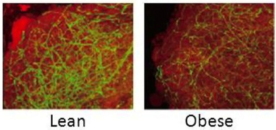 Normal brown fat (left) is fed by many blood vessels, seen here in green. In obese mice, blood vessels feeding the brown fat shriveled and disappeared. Slides courtesy of Kenneth Walsh