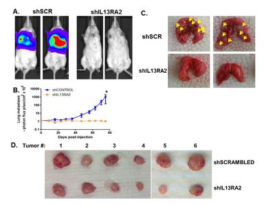 Knock-down of IL13RA2 suppresses lung metastasis
