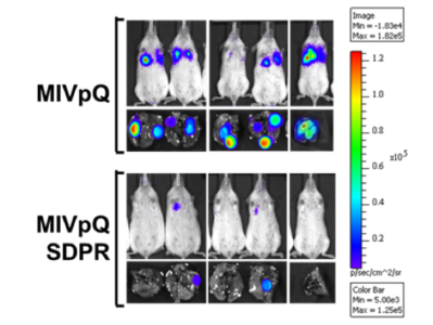 SDPR suppresses lung colonization of breast cancer