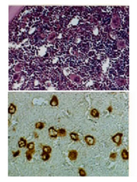 IHC of megakaryocytes