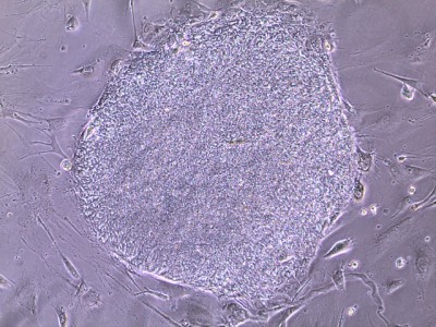 Human iPS Cells (PiZZ)