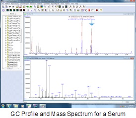 GC Profile