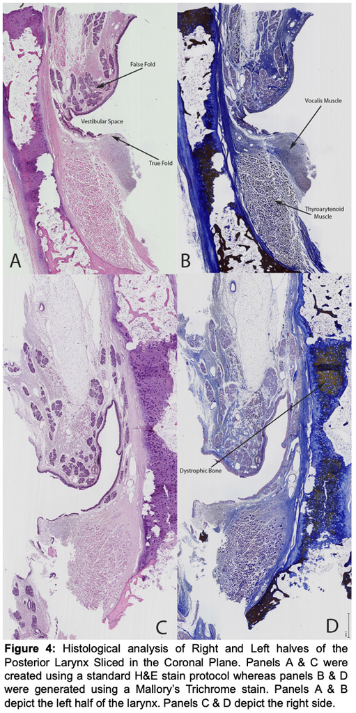 Translational Anatomy of Neurodegenerative Disease & Developmental ...