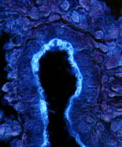 plate-2-airway-tubulin-c