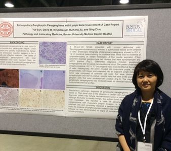 Yue.Sun.2015.ASCP.Poster3.paraganglioma