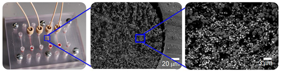 BU Impact Cancer 2 Microfluidic device for nucleic acid extraction from human samples. Shown here are the microchannel array and the porous polymer with beads, which are used to capture nucleic acids from cells. (Catherine Klapperich, Jennifer Rosen).