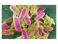 E. coli Enterohemorrhagic (EHEC) (photo courtesy of heal-all.org)