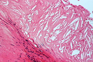 COM-Atherosclerosis