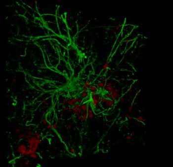 COM Microglia