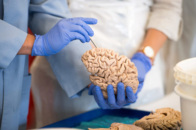 SPIN, the Summer Program in Neuroscience, is an eight-week course for undergraduates to integrate neuroscience research, hands-on teaching of human neuroanatomy, and clinical neurosurgery. It allows them experiences they otherwise wouldn’t have until graduate school.