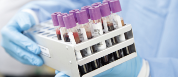 Blue-gloved hand holding samples of blood in tubes with pink caps