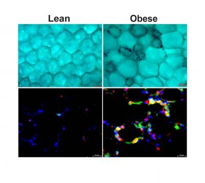 adipose tissue from lean and obese mice