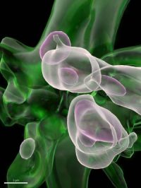 Alzheimer's brain cell - translucent white against green background