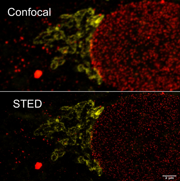 Nuclear pores and golgi