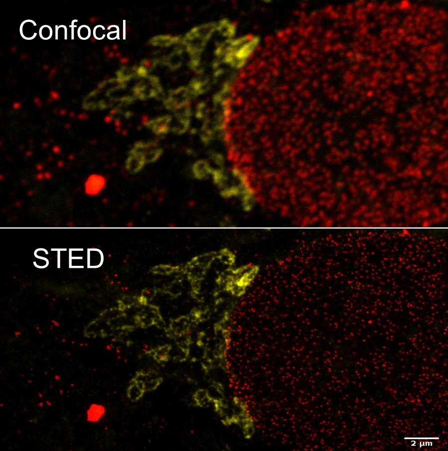 Abberior STED SuperResolution Microscope Chobanian & Avedisian School of Medicine