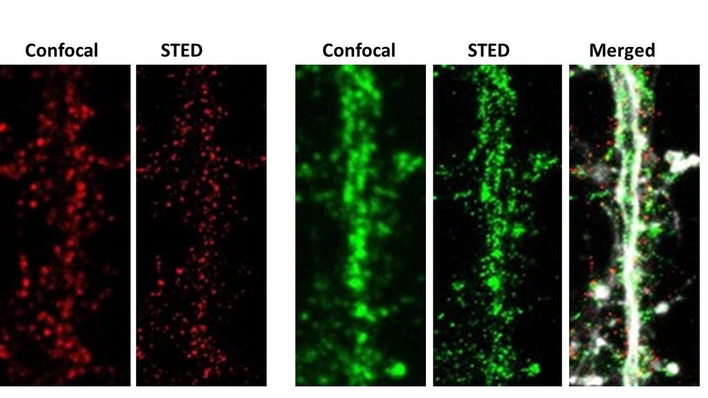 Abberior STED SuperResolution Microscope Chobanian & Avedisian School of Medicine