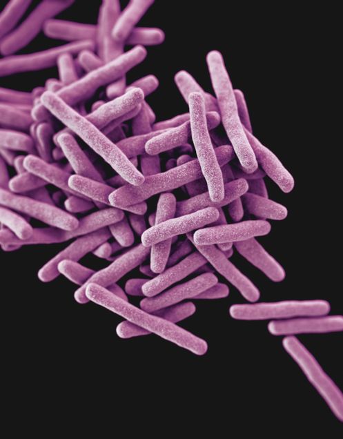 purple tuberculosis