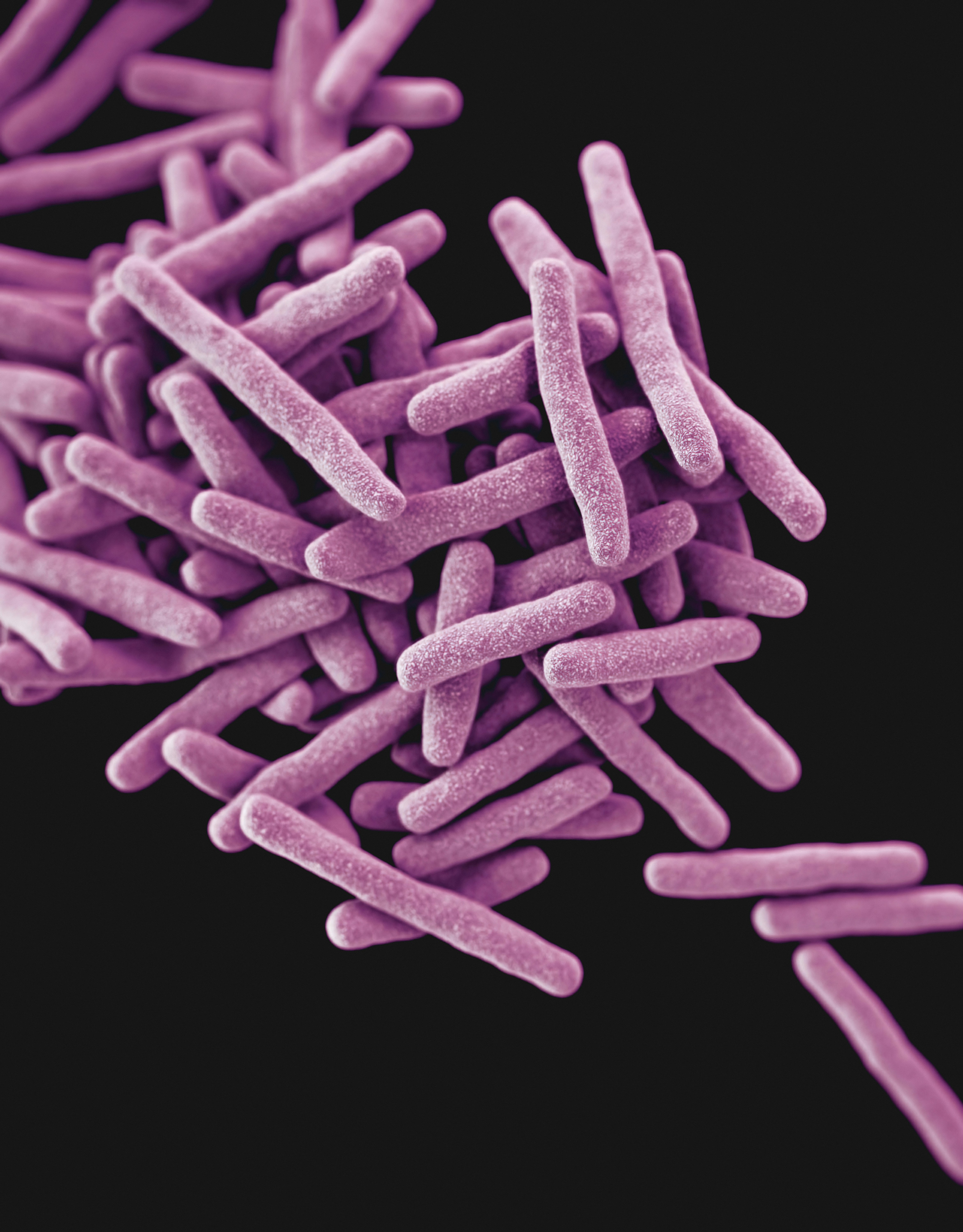 purple tuberculosis