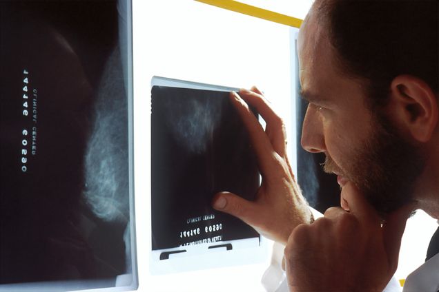 Doctor reading a mammogram