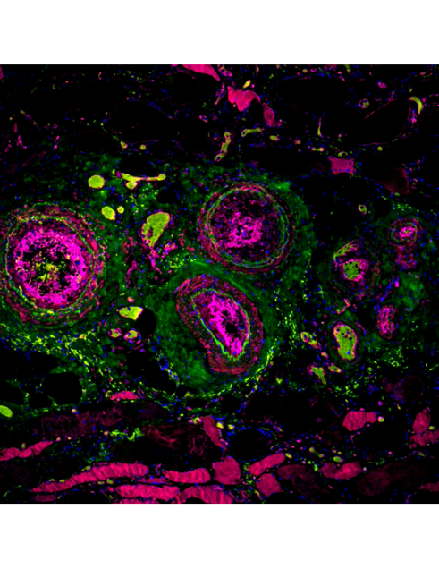 Three small pink circles surrounded by green, red, blue flecks on dark background