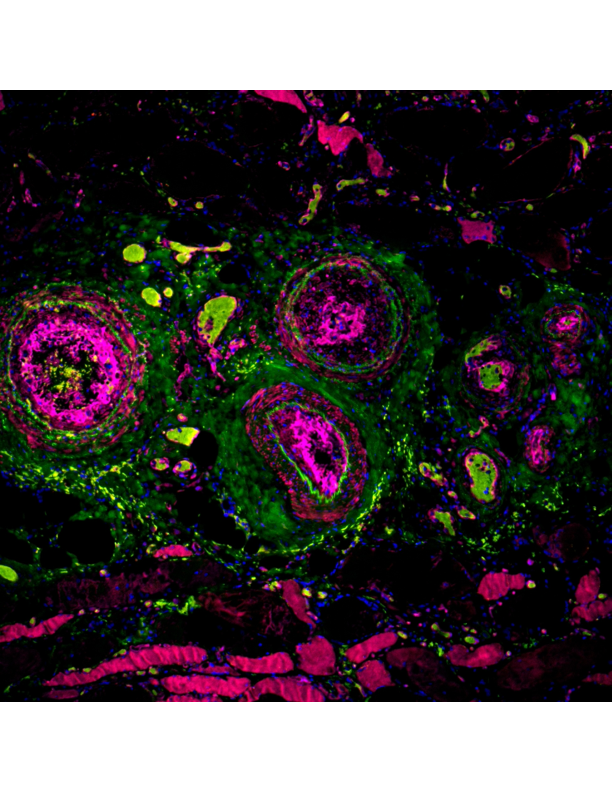 Three pink circles surrounded by red, green, blue flecks against dark background
