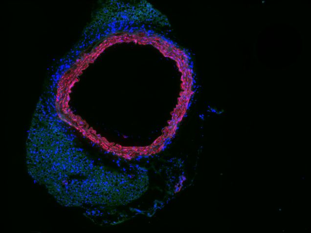 black background red and blue staining