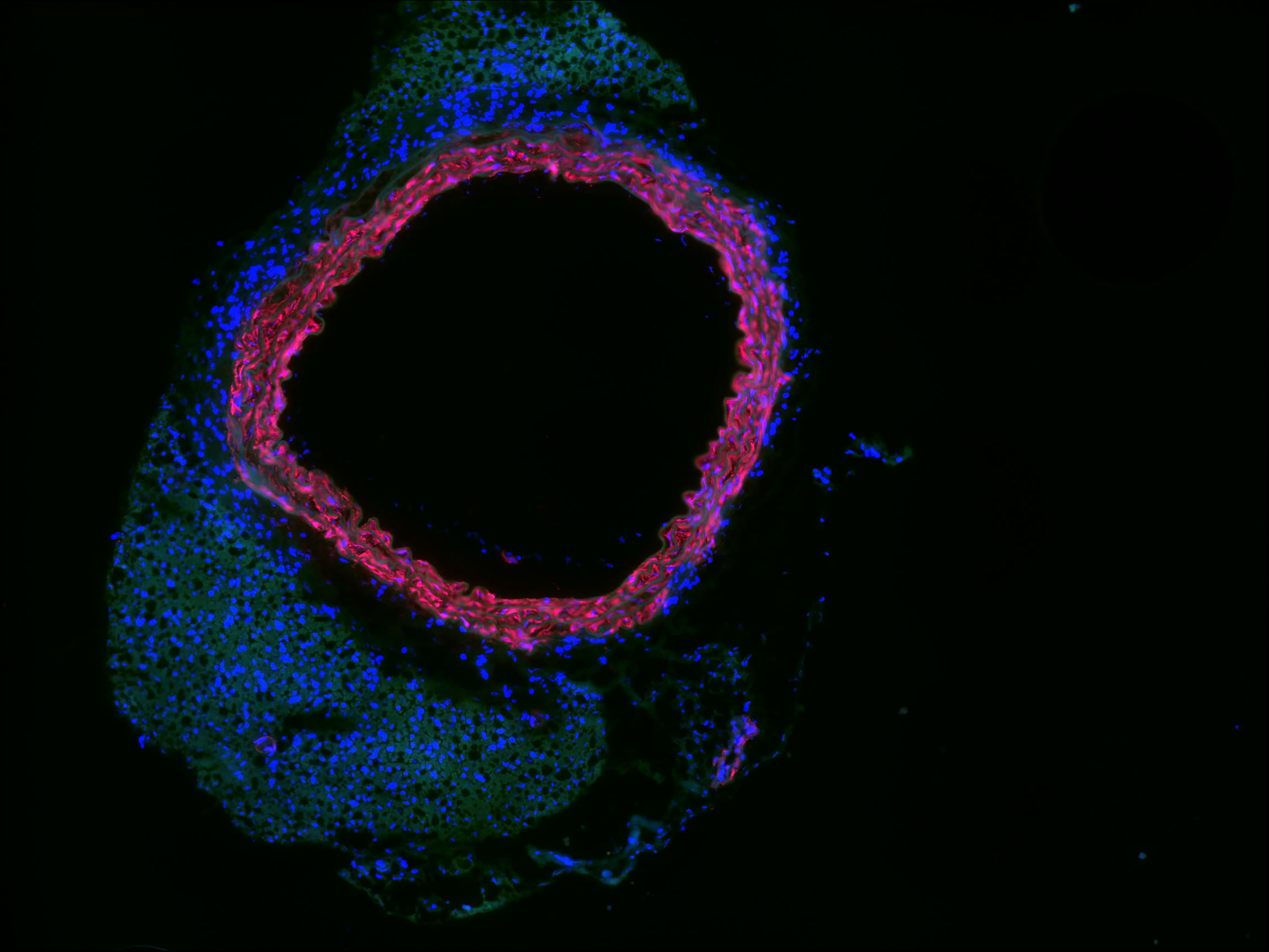 black background red and blue staining