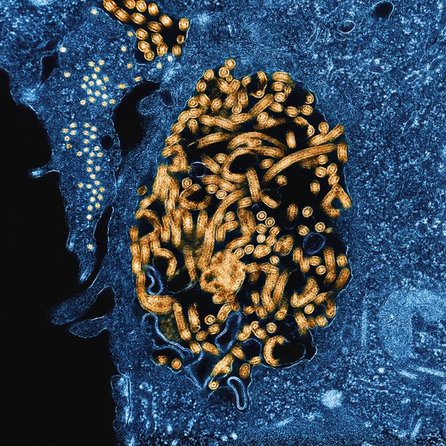 small and large orange circles representing ebola virus particles
