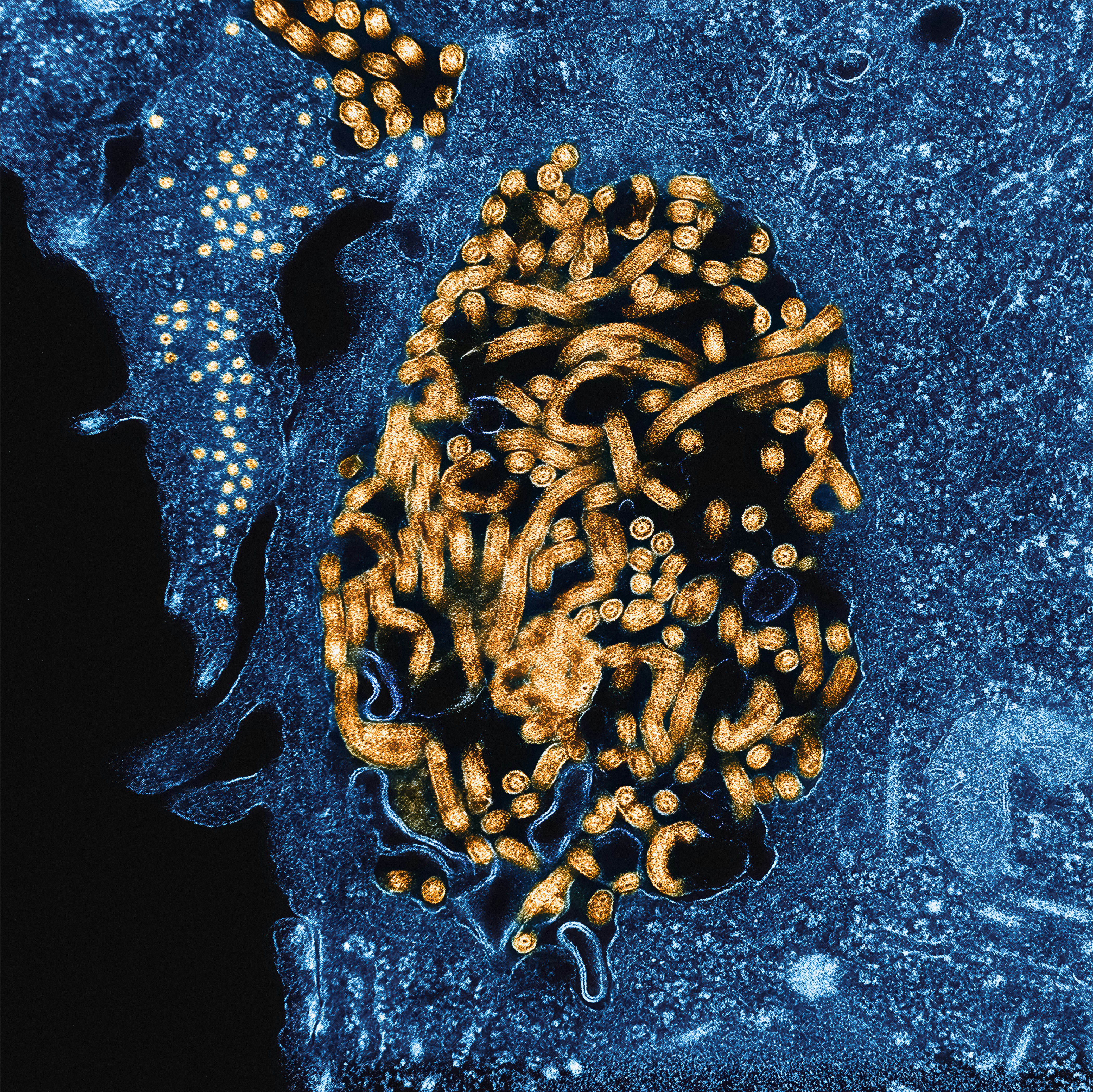 small and large orange circles representing ebola virus particles