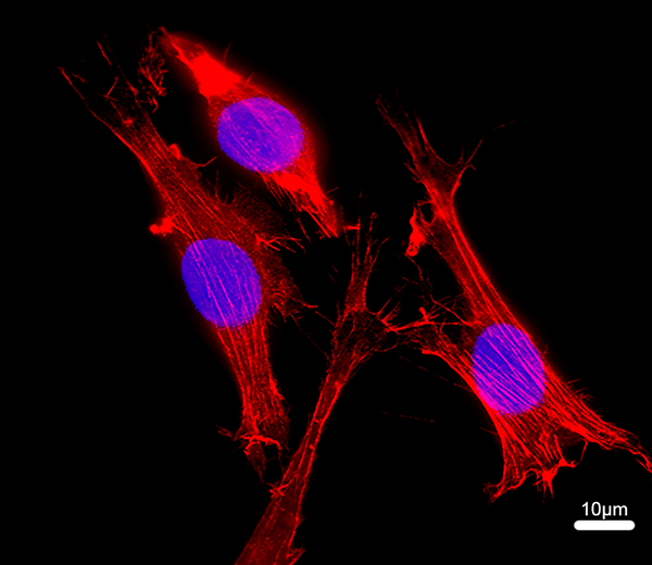 blue and red staining against black background