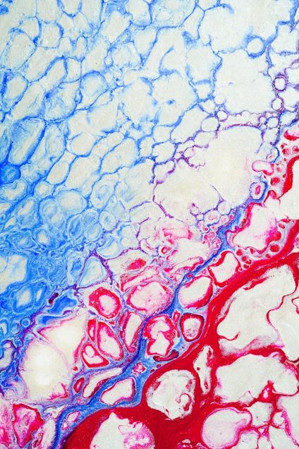 Blue and red representation of blood vessels