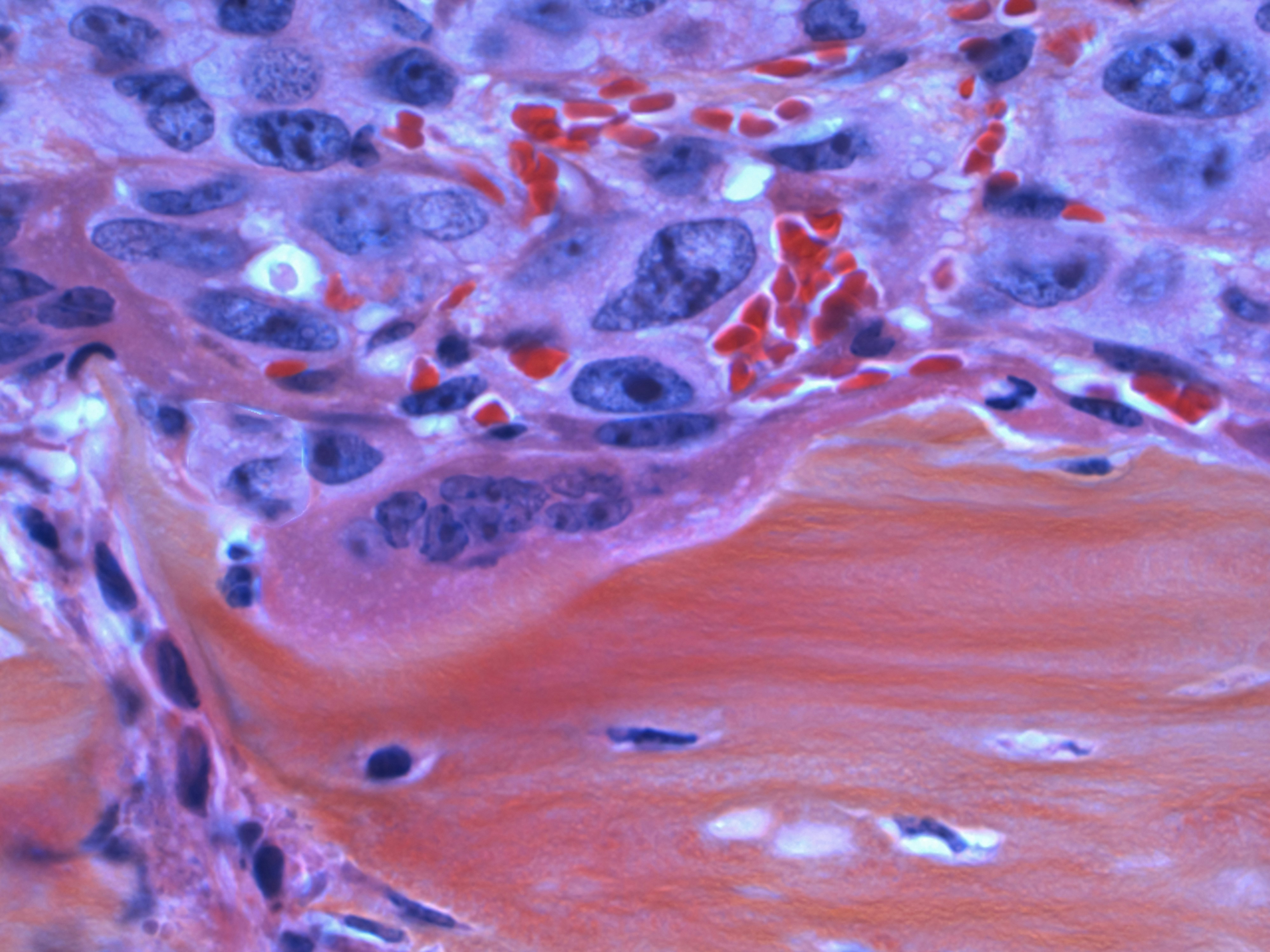 pink, light purple and blue images