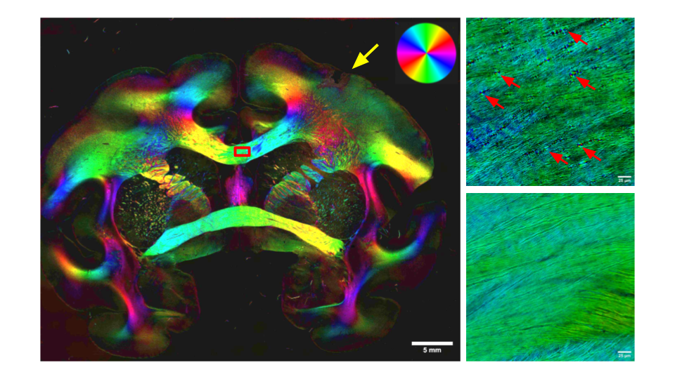 Myelin in brain represented by bright colors