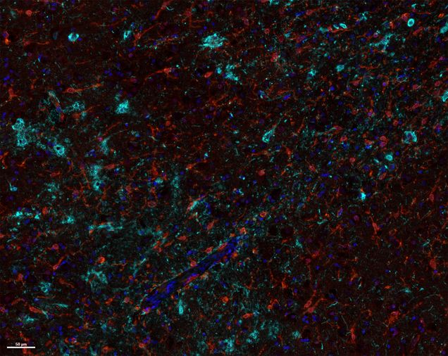 Black background with multicolored specs representing how the brain is impacted by CTE
