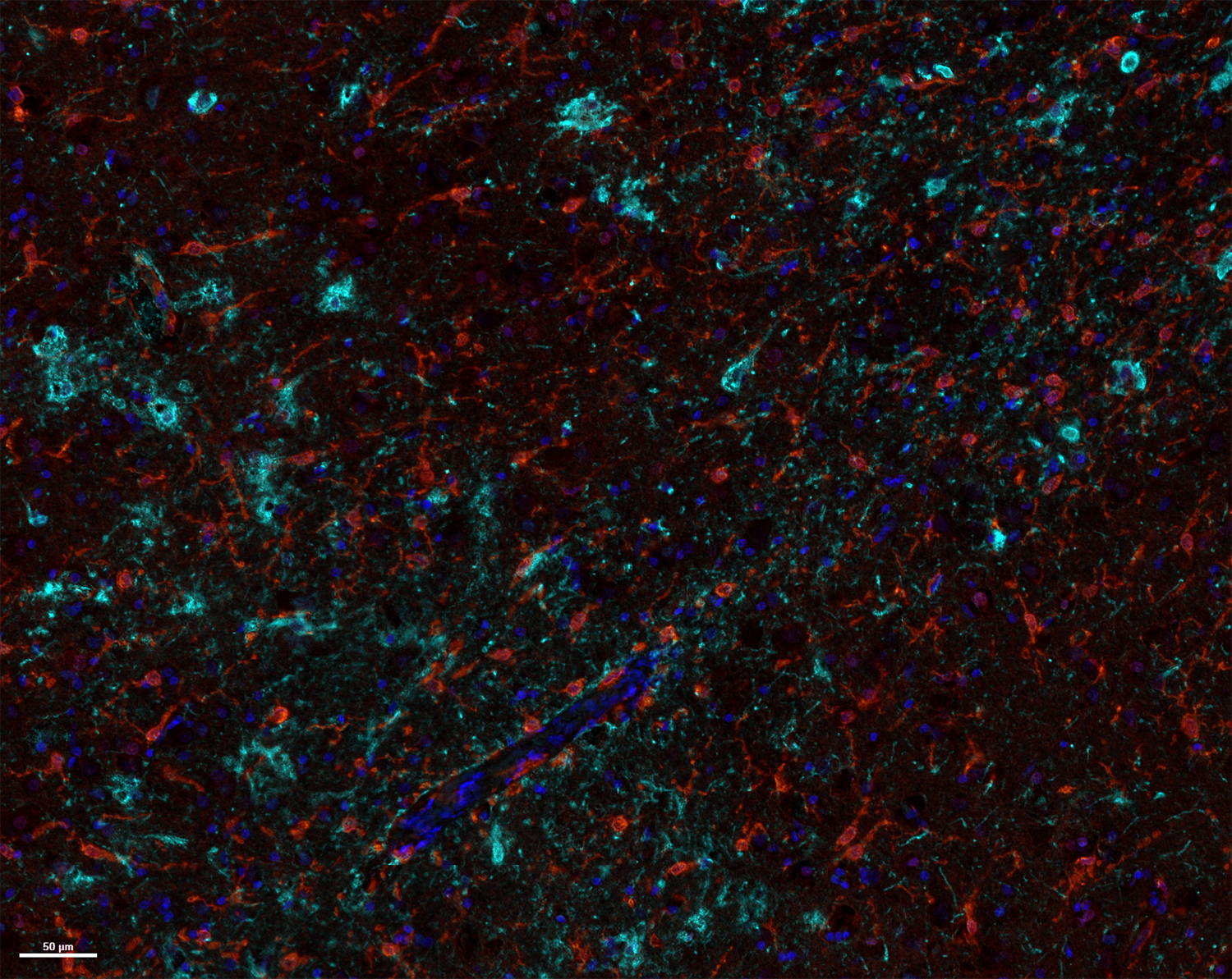 Black background with multicolored specs representing how the brain is impacted by CTE
