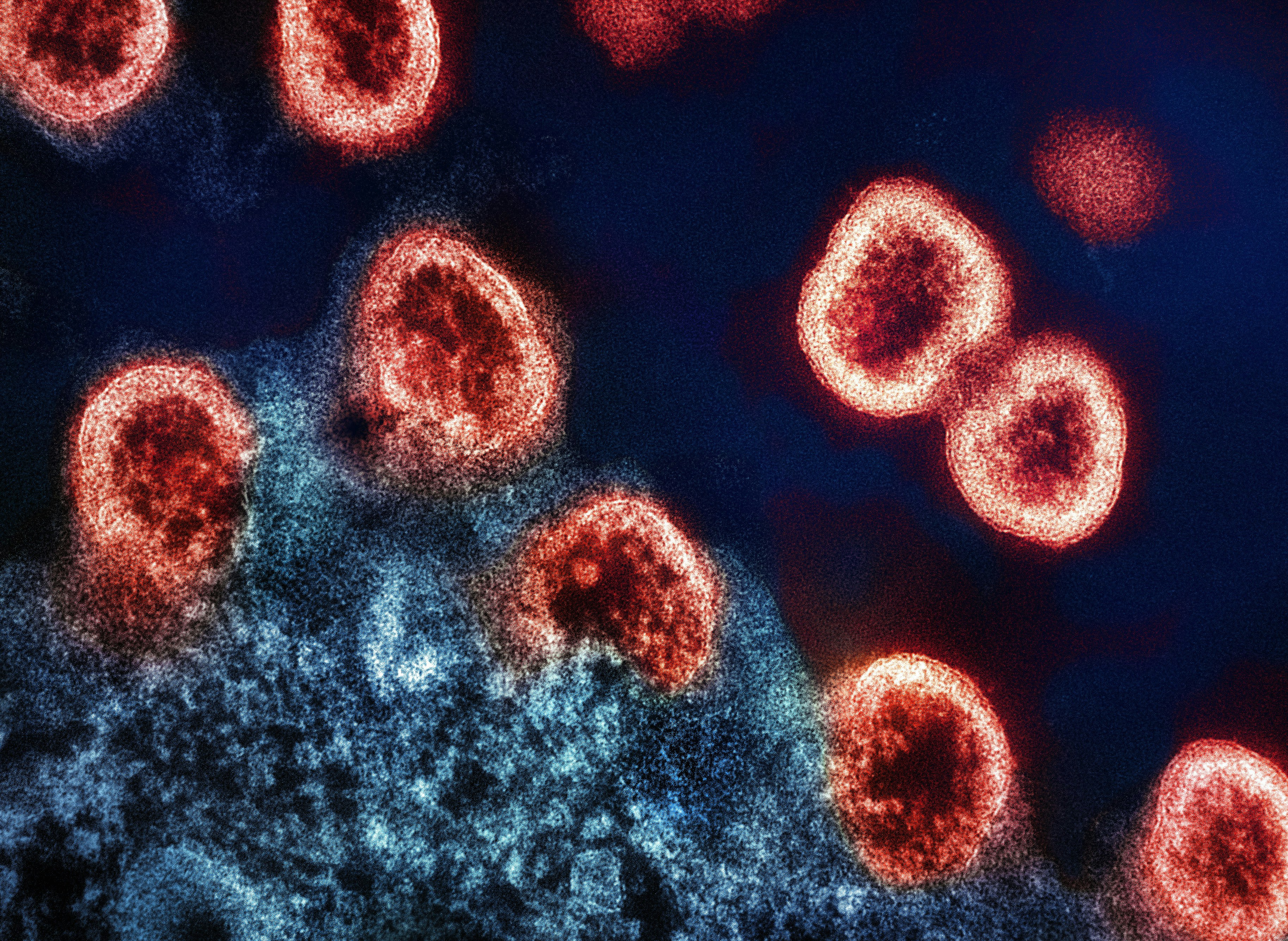 A group of red and black cells on a blue background-