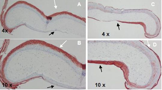 Figure 1. Epiboly analysis for keratinocyte migration by immunostaining. 