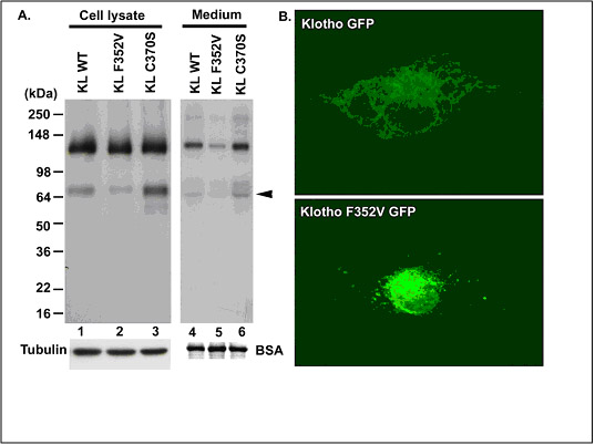 Klotho variants affect trafficking. A. Western blotting analysis of Klotho processing and secretion in COS-7 cells transiently expressing Klotho WT and variants. Note that Klotho trafficking was reduced inside (Cell lysate) and outside (Medium) for F352V variant, and increased for C370S variant. Tubulin and BSA were used as controls. Arrow indicates the 68 kDa Klotho fragment. B. Fluorescent microscopy of Klotho WT GFP and F352V GFP fusion protein. Note the strikingly different cellular distribution