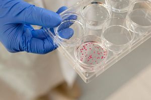 http://www.nhlbi.nih.gov/health/health-topics/topics/sca/ .