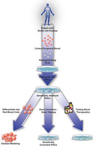 sickle cell diagram George Murphy BU Today The diagram above illustrates the process of creating induced pluripotent stem cells from patients' blood samples. These identical stem cells can then be used for gene therapy or for disease modeling and drug testing. Diagram courtesy of George Murphy