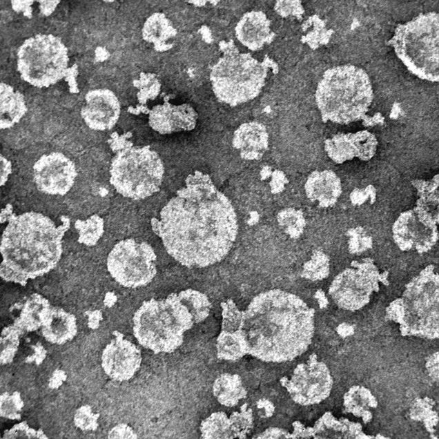 Transmission electron micrograph of lipid-coated nanoparticles engineered for localized delivery of siRNA for cancer therapy