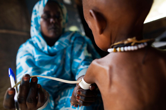 A nurse measures the arm of a child suffering from severe malnutrition at a clinic run by the NGO Kuwait Patient Helping Fund in the Abu Shouk camp for internally displaced persons in North Darfur. Photo by Albert González Farran, United Nations Hybrid Operation in Darfur