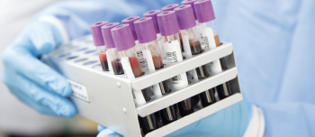 Blued-gloved hand holding blood samples in tubes with pink tops with white labels