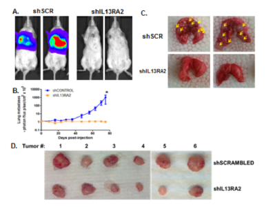 Knock-down of IL13RA2 suppresses lung metastasis 